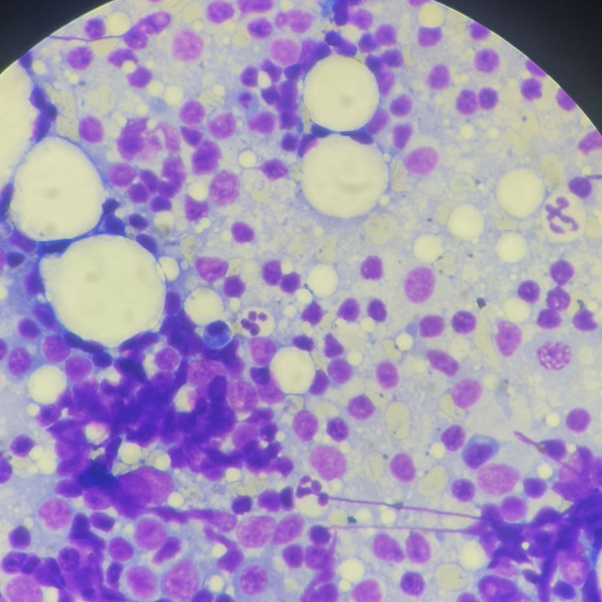 resultados análisis microscopio 3