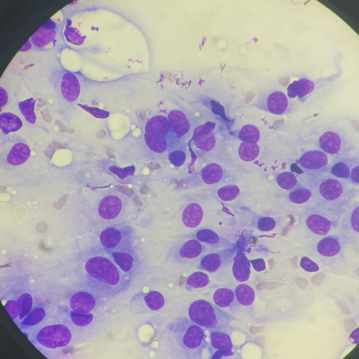 resultados análisis microscopio 2