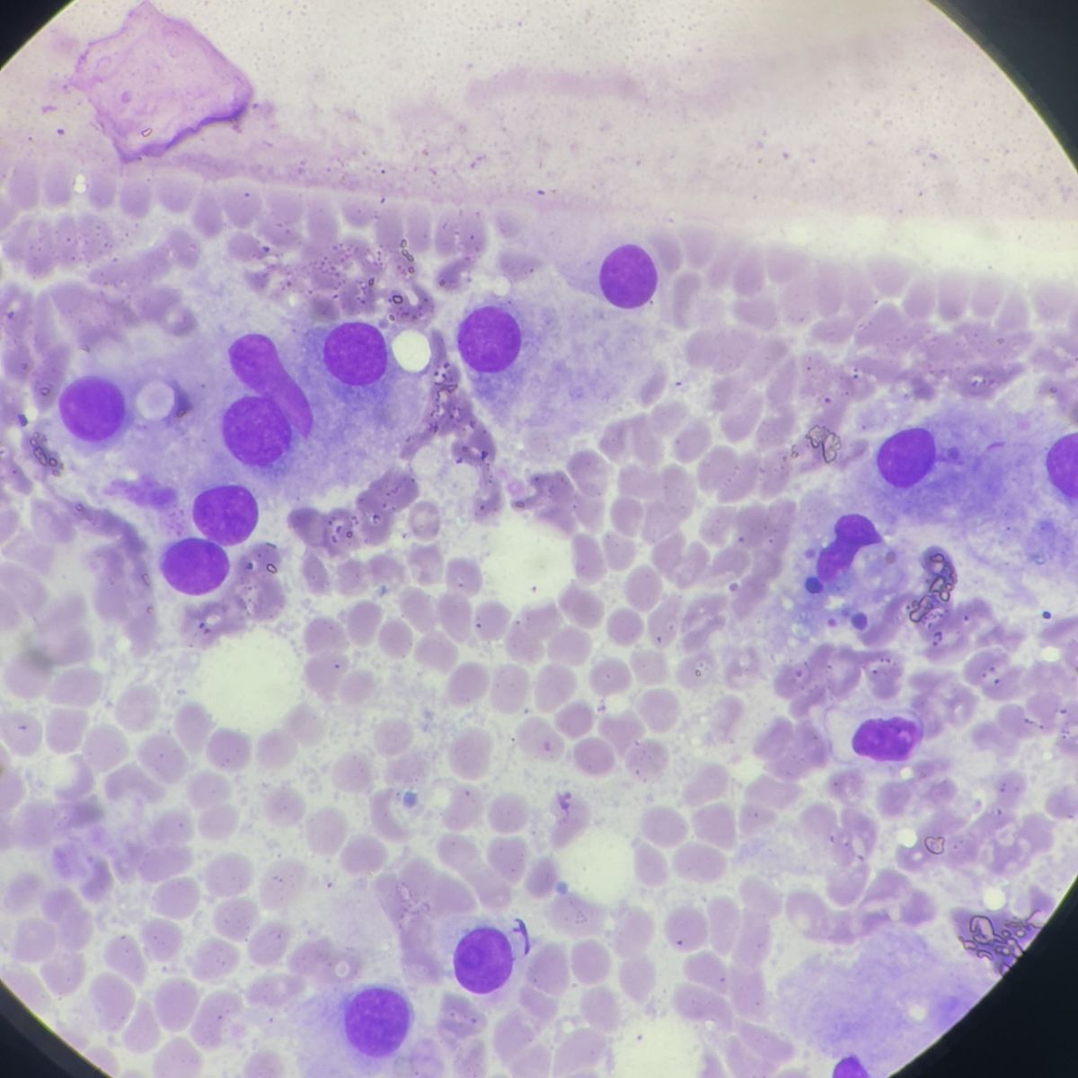 resultados análisis microscopio